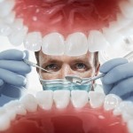 dental implants san jose ca