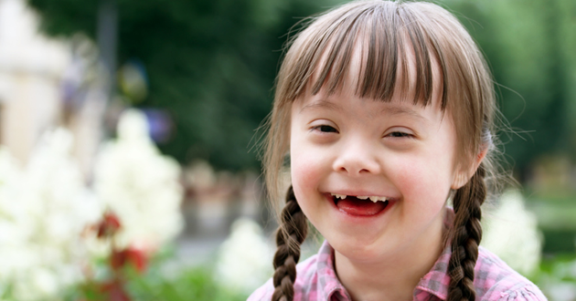 down syndrome common dental problems