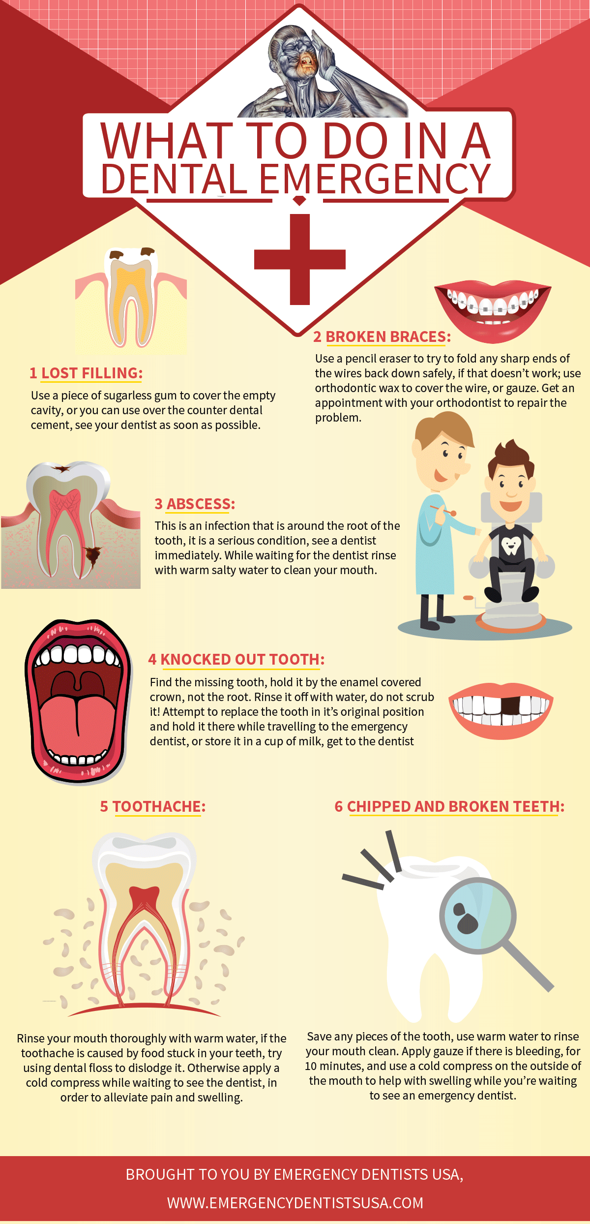 What To Do In Dental Emergency Infographic