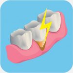 gentle dental care featured image
