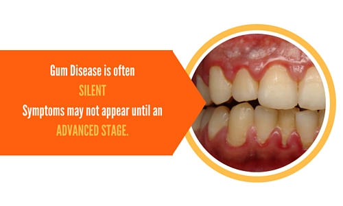 gum disease symptoms