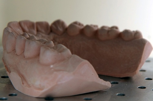 mouth guard image