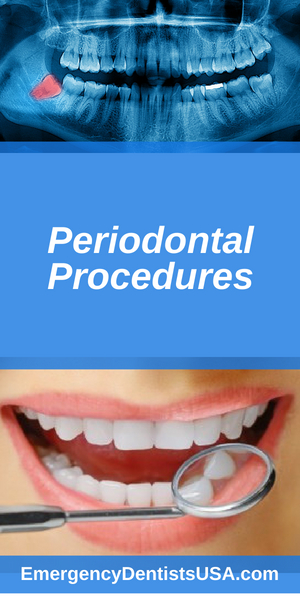 periodontal procedures