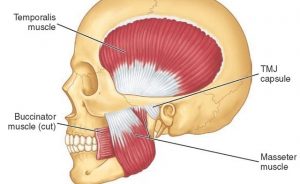 stiff jaw causes and cures