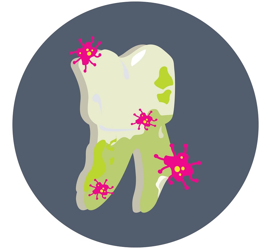 teeth infection image