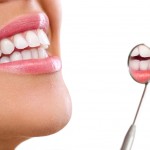 teeth whitening los angeles