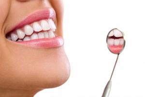 teeth whitening los angeles