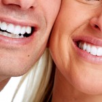 teeth whitening san diego