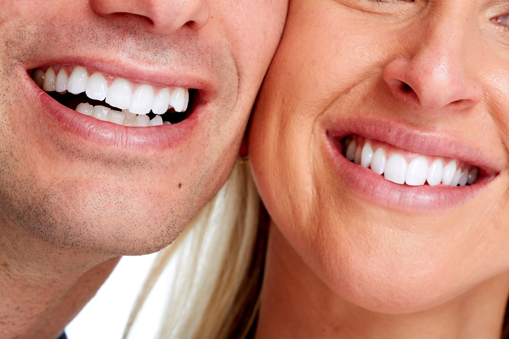 Teeth Whitening San Diego Find a Teeth Whitening Dentist!