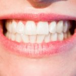 teeth alignment featured image