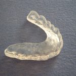 tmj splint featured image