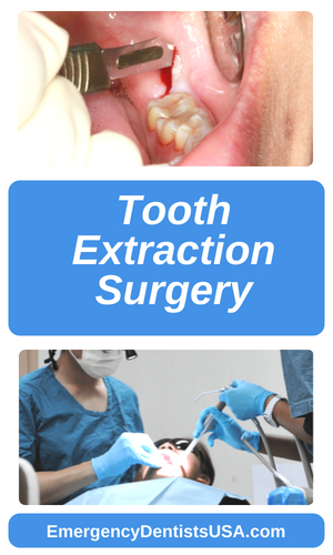 tooth extraction surgery