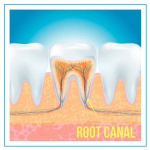 Endodontist Near Me [No Insurance OK] Root Canal Specialist