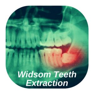 teeth extraction dentists