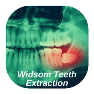 wisdom teeth extraction